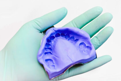 Dental Silicon Impression